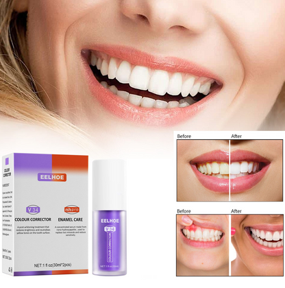Teeth Colour Corrector Serum