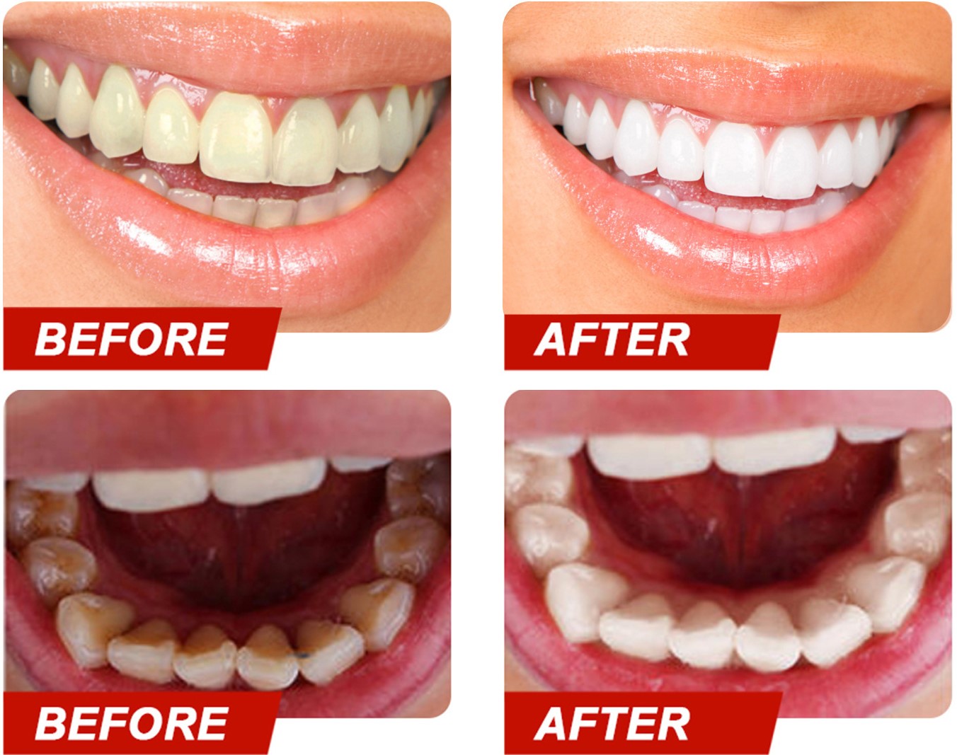 Teeth Colour Corrector Serum