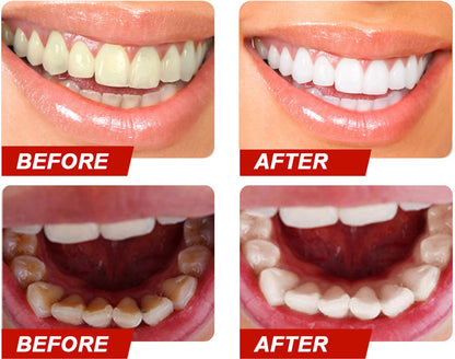 Teeth Colour Corrector Serum